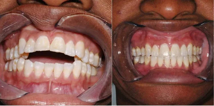 Jaw surgery case study