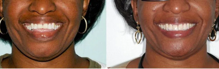 Jaw surgery case study