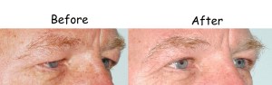 woman eye
