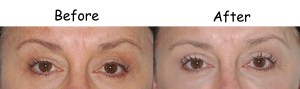 woman eye