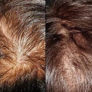 Image of a woman's head