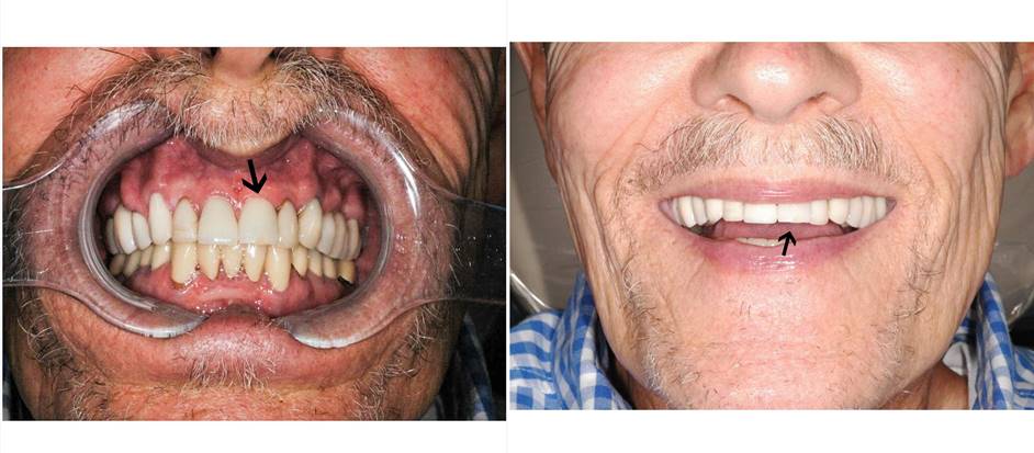 Jaw surgery case study