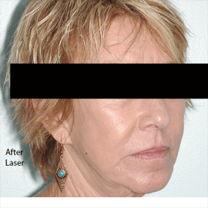Face of a woman