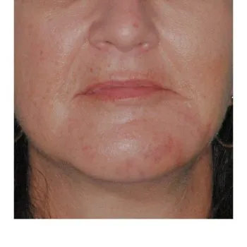 Face of a woman