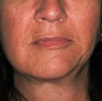 Face of a woman