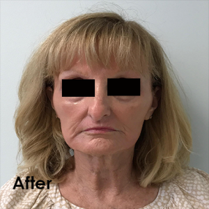 Face of a woman